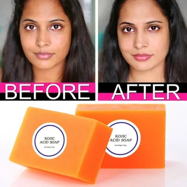 Sabonete clareador de pele com ácido kójico, 100g, com glutationa, sabonete clareador artesanal para rosto, 3 opções de cores disponíveis